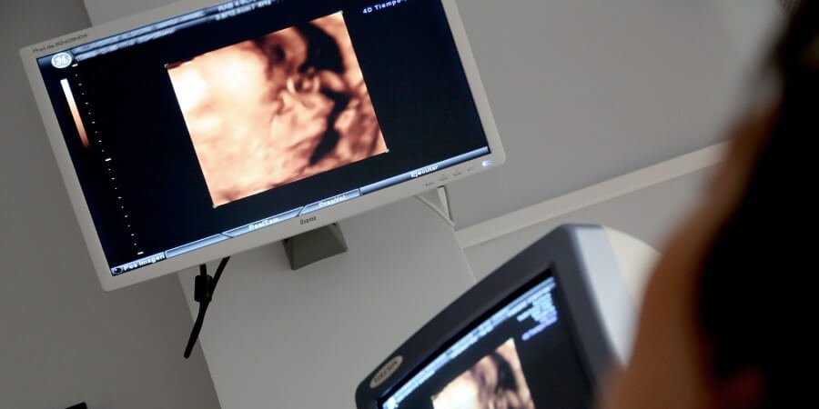 Como é feita a ultrassonografia obstétrica