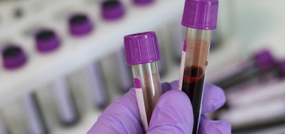 Exames laboratoriais para atletas