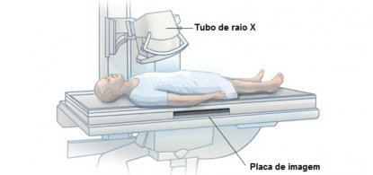 Raio X como funciona