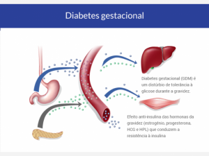 Tudo sobre diabetes gestacional