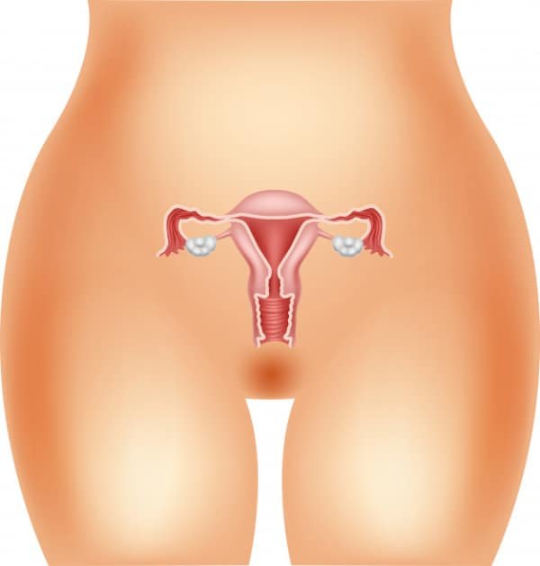 Tipos de endometriose 