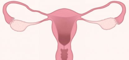 Tudo sobre endometriose
