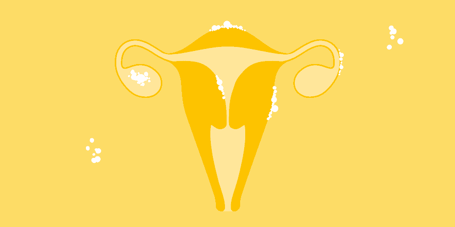 mitos-sobre-endometriose