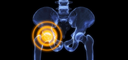 o-que-e-osteopenia