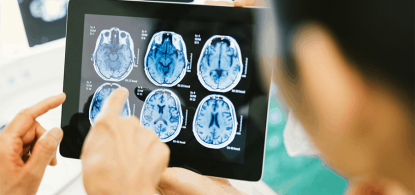 qual-exame-detecta-tumor-cerebral