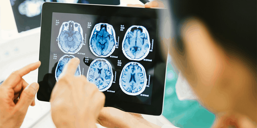 qual-exame-detecta-tumor-cerebral