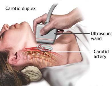 ultrassonografia-carotida